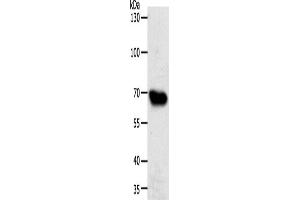 Western Blotting (WB) image for anti-ATP-Binding Cassette, Sub-Family G (WHITE), Member 1 (ABCG1) antibody (ABIN2426499)
