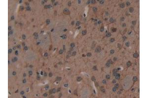 Immunohistochemistry (IHC) image for anti-Microtubule-Associated Protein 1A (MAP1A) (AA 2552-2759) antibody (ABIN7431635)