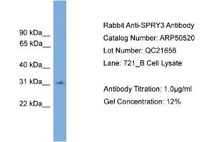 WB Suggested Anti-SPRY3  Antibody Titration: 0. (SPRY3 Antikörper  (N-Term))