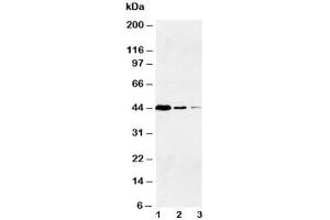 Western blot testing of Caspase-1 antibody and Lane 1:  Jurkat (Caspase 1 Antikörper  (Large Subunit, N-Term))