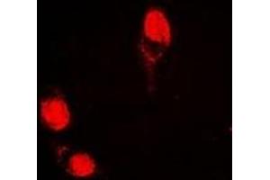 Immunofluorescent analysis of AGFG1 staining in HepG2 cells. (AGFG1 Antikörper)