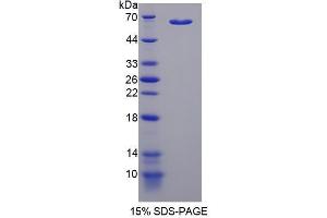 Image no. 1 for Malate Dehydrogenase 1, NAD (Soluble) (MDH1) (AA 2-334) protein (His tag,GST tag) (ABIN4990723) (MDH1 Protein (AA 2-334) (His tag,GST tag))