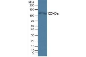 Western Blot; Sample: Human Hela Cells. (TLR5 Antikörper  (AA 693-858))