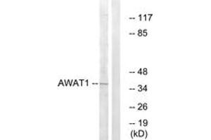 Western blot analysis of extracts from 293 cells, using AWAT1 Antibody. (AWAT1 Antikörper  (AA 261-310))