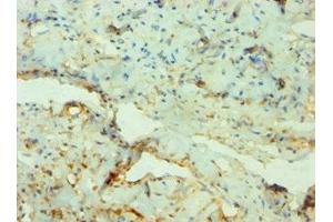 Immunohistochemistry (IHC) image for anti-serum/glucocorticoid Regulated Kinase Family, Member 3 (SGK3) (AA 1-150) antibody (ABIN7169180)