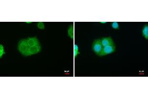 ICC/IF Image StAR antibody detects StAR protein at mitochondria by immunofluorescent analysis. (STAR Antikörper)