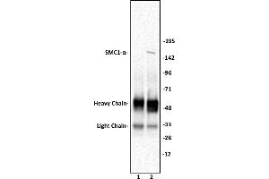 SMC1- a antibody (pAb) tested by Immunoprecipitation. (SMC1A Antikörper  (C-Term))