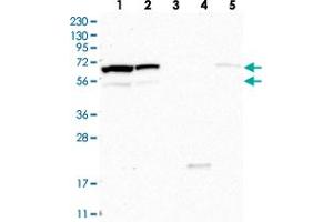 Western blot analysis of Lane 1: RT-4, Lane 2: U-251 MG, Lane 3: Human Plasma, Lane 4: Liver, Lane 5: Tonsil with CPSF3L polyclonal antibody . (CPSF3L Antikörper)