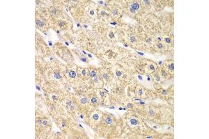 Immunohistochemistry of paraffin-embedded human liver injury using ACADS antibody at dilution of 1:100 (x40 lens). (ACADS Antikörper)
