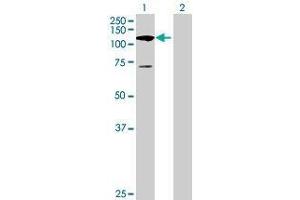 Lane 1: C11orf82 transfected lysate ( 111.