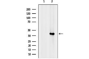 anti-R-Spondin 3 (RSPO3) (Internal Region) antibody