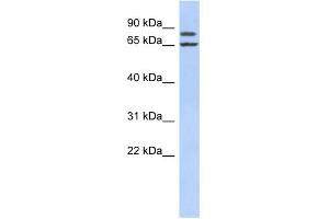 WB Suggested Anti-FSIP1 Antibody Titration: 0. (FSIP1 Antikörper  (Middle Region))