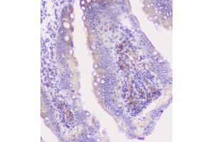 IHC analysis of CFP using anti-CFP antibody (ABIN6719298). (CFP Antikörper)