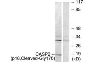 Western Blotting (WB) image for anti-Caspase 2, Apoptosis-Related Cysteine Peptidase (CASP2) (AA 151-200), (Cleaved-Gly170) antibody (ABIN2891170) (Caspase 2 Antikörper  (Cleaved-Gly170))