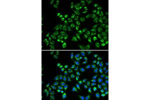 Immunofluorescence analysis of HeLa cells using C1QBP antibody. (C1QBP Antikörper)