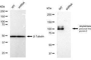 Western blotting analysis using Amyloid beta precursor like protein 2 antibody (ABIN7797595). (Rekombinanter APLP2 Antikörper)