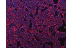 IF analysis of ATP5F1B using anti-ATP5F1B antibody (ABIN7599866). (Atp5f1b (AA 123-529) Antikörper)