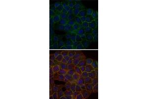 Immunofluorescence analysis of HepG2 cells using BLNK monoclonal antibody, clone 5G9  (green). (B-Cell Linker Antikörper)