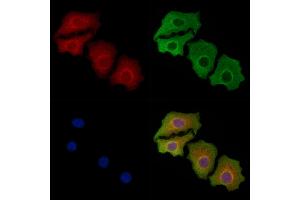 ABIN6258194 and ABIN6273898 staining Hela cells by IF/ICC. (GPR83 Antikörper  (N-Term))
