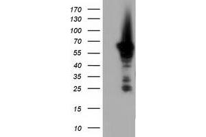 Western Blotting (WB) image for anti-Adenylate Kinase 5 (AK5) antibody (ABIN1496534) (Adenylate Kinase 5 Antikörper)