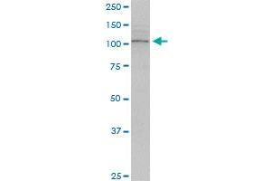 TRPV1 monoclonal antibody (M01), clone 1F5. (TRPV1 Antikörper  (AA 21-124))