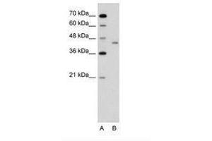 Image no. 1 for anti-LRP2 Binding Protein (LRP2BP) (AA 151-200) antibody (ABIN6736640) (LRP2BP Antikörper  (AA 151-200))