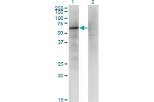 Western Blot analysis of ZNF34 expression in transfected 293T cell line by ZNF34 monoclonal antibody (M03), clone 1B11. (ZNF34 Antikörper  (AA 104-203))