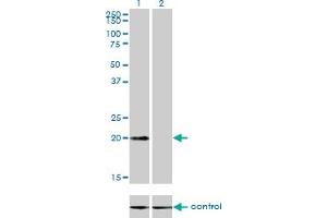 Western blot analysis of CSRP3 over-expressed 293 cell line, cotransfected with CSRP3 Validated Chimera RNAi (Lane 2) or non-transfected control (Lane 1). (CSRP3 Antikörper  (AA 95-194))