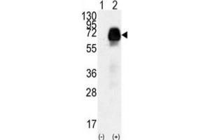 Western Blotting (WB) image for anti-Anti-Mullerian Hormone Receptor, Type II (AMHR2) antibody (ABIN3002999) (AMHR2 Antikörper)