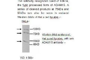 Image no. 1 for anti-ADAM Metallopeptidase Domain 15 (ADAM15) antibody (ABIN790768)