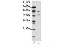 Image no. 1 for anti-Nuclear Receptor Subfamily 1, Group H, Member 3 (NR1H3) (N-Term) antibody (ABIN202546) (NR1H3 Antikörper  (N-Term))