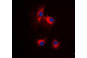 Immunofluorescent analysis of MRPL15 staining in HuvEc cells. (MRPL15 Antikörper  (Center))