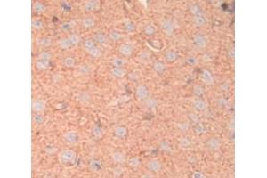 IHC-P analysis of Rat Tissue, with DAB staining. (MGP Antikörper  (AA 20-103))
