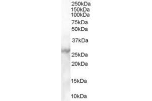 ABIN185321 (1µg/ml) staining of Human Heart lysate (35µg protein in RIPA buffer). (MBL2 Antikörper  (C-Term))