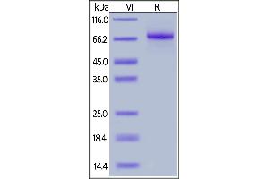 SDS-PAGE (SDS) image for Interleukin 12 Receptor beta 1 (IL12RB1) (AA 24-540) (Active) protein (His tag) (ABIN6809932)