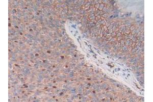 Figure. (S100A14 Antikörper  (AA 1-91))