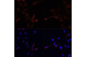 Immunofluorescence analysis of C6 cells using MAP1LC3B antibody (ABIN1876926) at dilution of 1:100. (LC3B Antikörper)