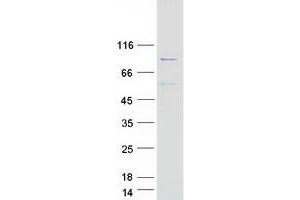 Validation with Western Blot (ADD2 Protein (Myc-DYKDDDDK Tag))