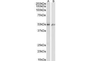 ABIN1686793 (1µg/ml) staining of Human lung (A) and Human Umbilical Cord (B) lysates (35µg protein in RIPA buffer). (ECSCR Antikörper  (C-Term))