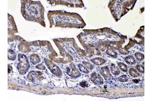 Immunohistochemistry (IHC) image for anti-UDP Glucuronosyltransferase 1 Family, Polypeptide A1 (UGT1A1) (AA 316-533) antibody (ABIN5693290)
