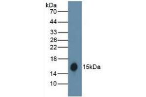Detection of recombinant HB using Polyclonal Antibody to Hemoglobin (HB) (Hemoglobin Antikörper)