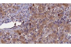 Immunohistochemistry (IHC) image for anti-ATP-Binding Cassette, Sub-Family G (WHITE), Member 8 (ABCG8) (Internal Region) antibody (ABIN6259696)