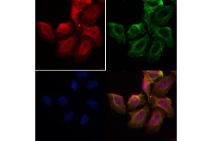 ABIN6258322 and ABIN6274167 staining Hela by IF/ICC. (SKIL Antikörper  (C-Term))