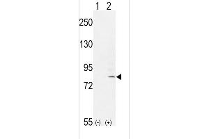 Western blot analysis of FGFR1 (arrow) using rabbit polyclonal FGFR1- (ABIN653771 and ABIN2843063). (FGFR1 Antikörper  (AA 285-314))