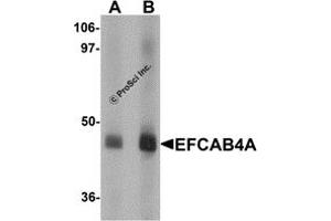 Western Blotting (WB) image for anti-EF-Hand Calcium Binding Domain 4A (EFCAB4A) (Middle Region) antibody (ABIN1030922)