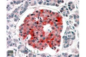Immunohistochemistry (IHC) image for anti-Potassium Inwardly-Rectifying Channel, Subfamily J, Member 11 (KCNJ11) (Internal Region) antibody (ABIN238541)