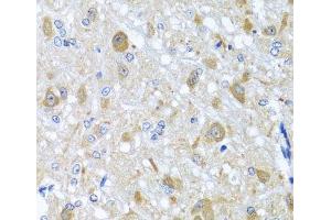 Immunohistochemistry of paraffin-embedded Rat brain using BNIP3L Polyclonal Antibody at dilution of 1:100 (40x lens). (BNIP3L/NIX Antikörper)