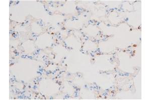 ABIN6267603 at 1/200 staining Rat lung tissue sections by IHC-P. (PKC theta Antikörper  (pSer676))