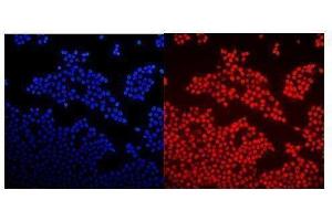 IF analysis of GNAQ using anti-GNAQ antibody (ABIN3043833).