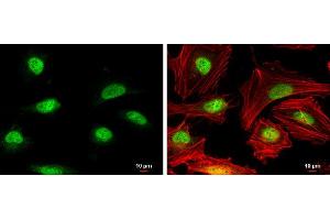 ICC/IF Image Rad51 antibody [N1C2] detects Rad51 protein at nucleus by immunofluorescent analysis. (RAD51 Antikörper  (Center))